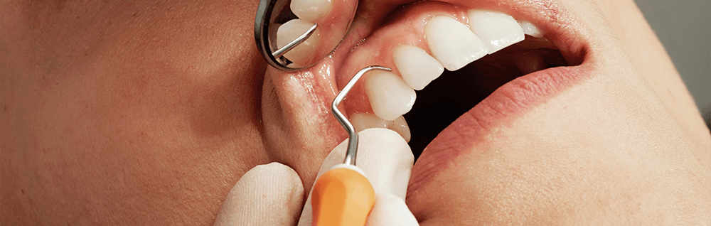 Zahnbehandlung Dr. Ringens